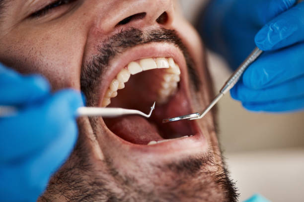 Sedation Dentistry in Platte City, MO