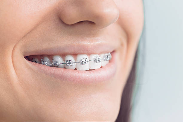 Best Invisalign and Clear Aligners  in Platte City, MO